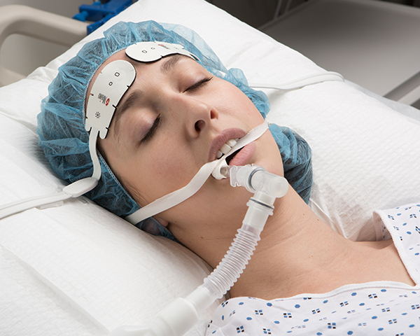 Schlafender intubierter Patient in einem Krankenhauskittel und einer Chirurgiehaube wird mit einem Masimo-Stirnsensor überwacht.
