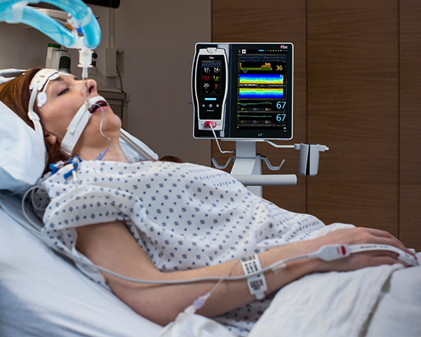 Patient wird mit SedLine und O3 an Root in einem PACU-Bereich überwacht