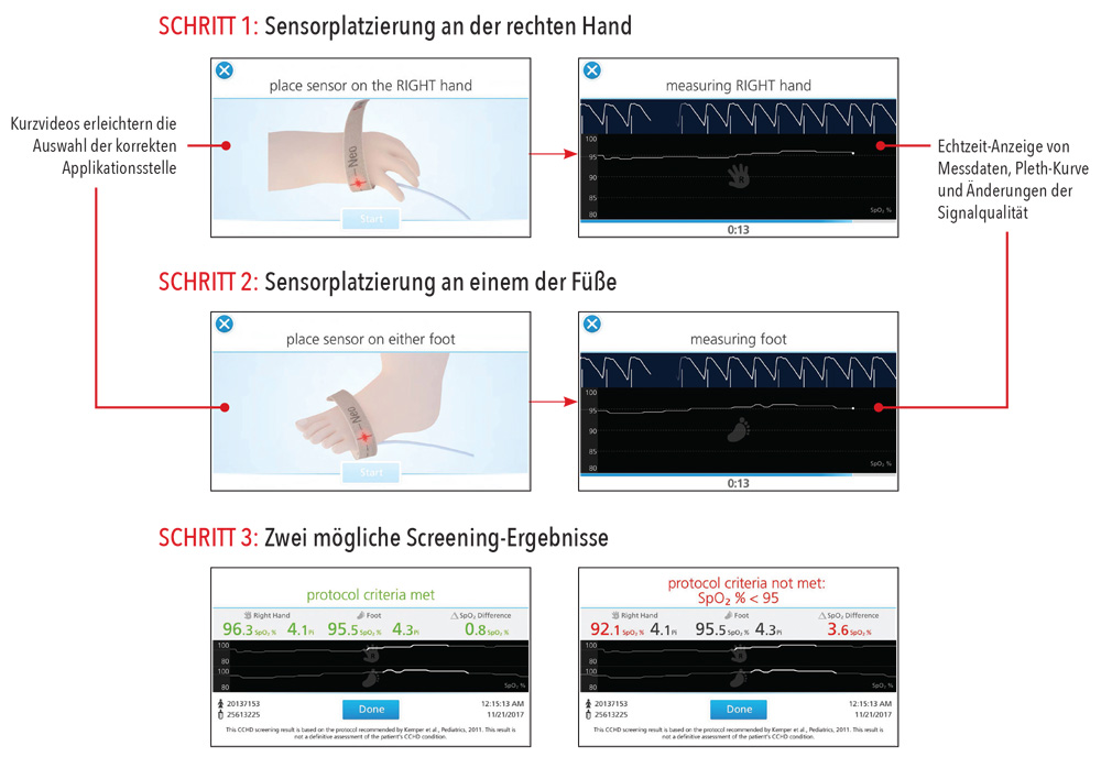 Masimo - Schritt-für-Schritt-Anleitung verbessert Durchgängigkeit, Genauigkeit und Effizienz des Ablaufs