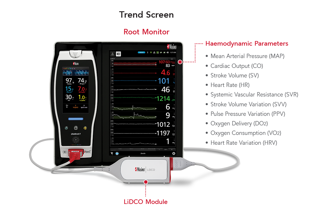 Wichtige Funktionen des LiDCO auf dem Masimo Root Anzeigemonitor