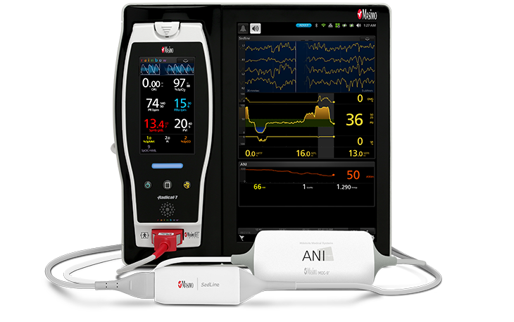 Masimo – Root mit ANI- und O3-Regional-Oximetrie