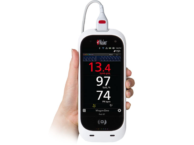 Masimo – Rad-67 Pulse CO-Oximeter für Spotcheck-Messungen