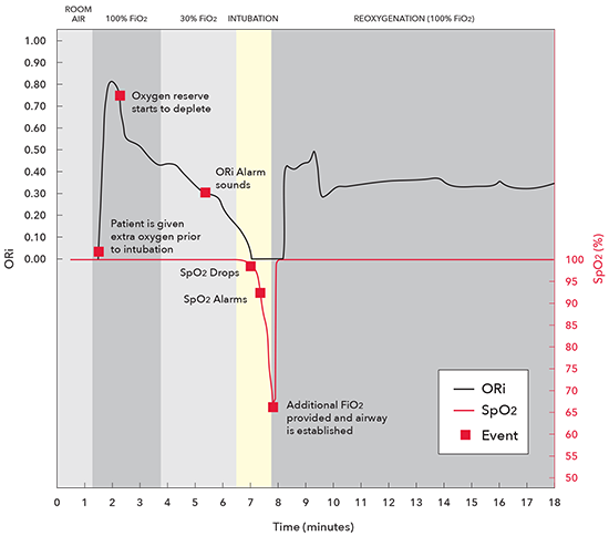 Masimo - ORi - Klinische Anwendung Graph