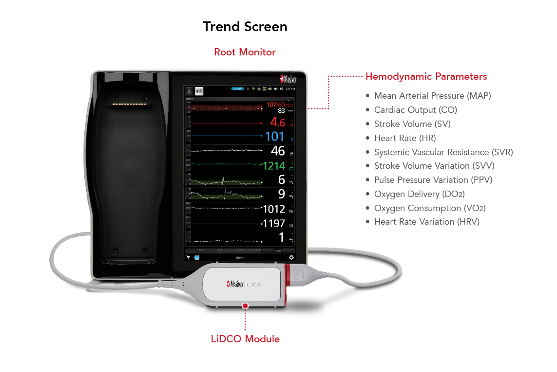 Wichtige Funktionen des LiDCO auf dem Masimo Root Anzeigemonitor