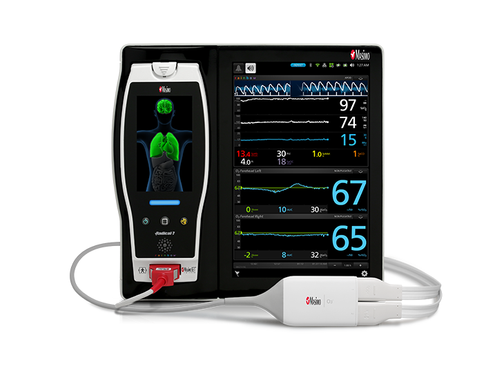 Masimo – O3®-Regional-Oximetrie