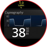 Masimo – Rad-97 mit Kapnographie