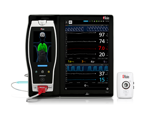 Masimo – Root mit NomoLine-Kapnographie