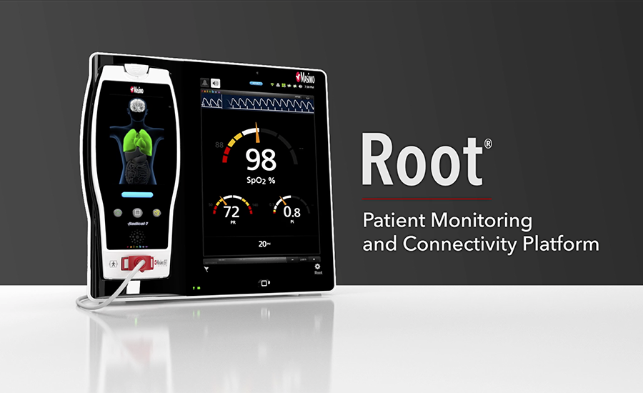 video thumbnail of Root video