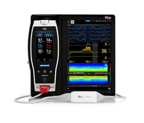 Masimo – Root mit SedLine-Gehirnfunktionsüberwachung