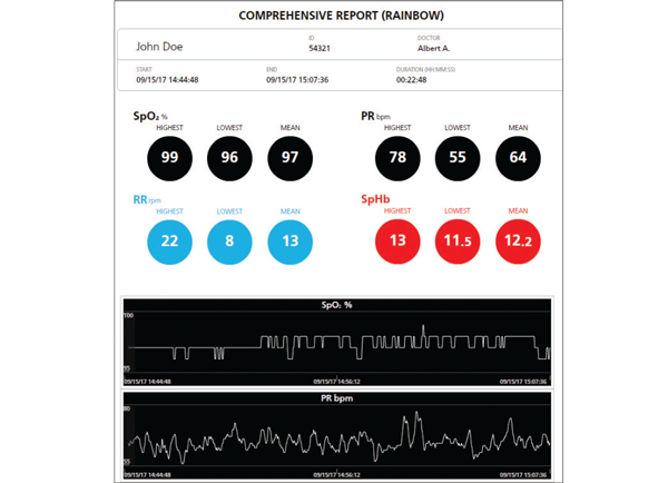 Masimo – Trace – Umfassender Bericht