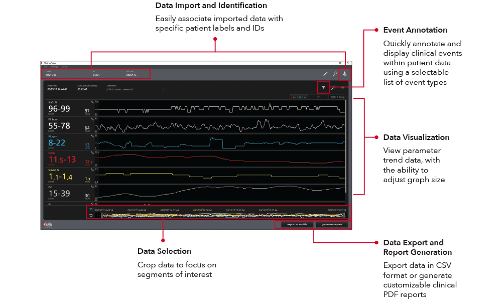 Masimo – Trace – Datenanzeige