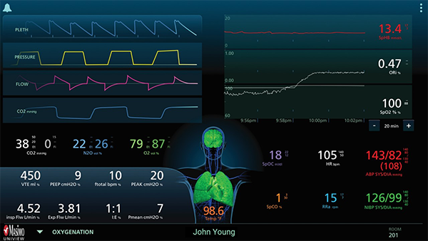 Masimo - UniView - Oxygenierungslayout