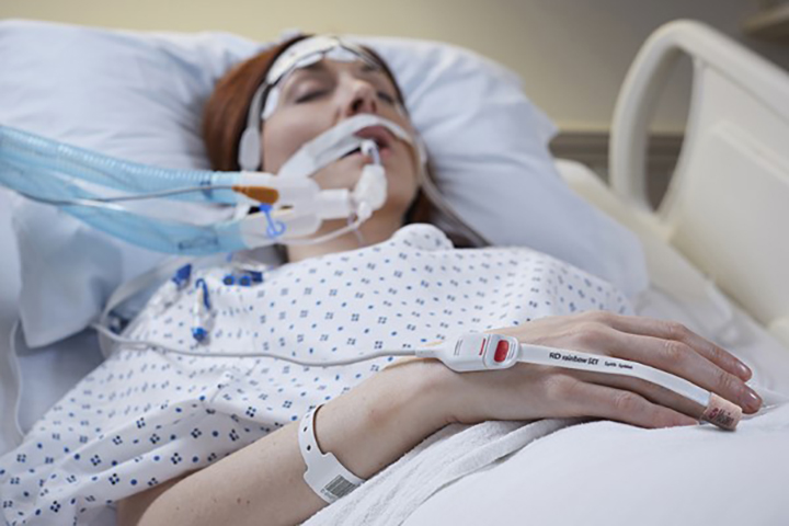 Video-Miniaturansicht eines intubierten Patienten 