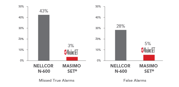 Masimo - Alarmzuverlässigkeit durch Signalextraktionsleistung während Bewegung und schwacher Durchblutung