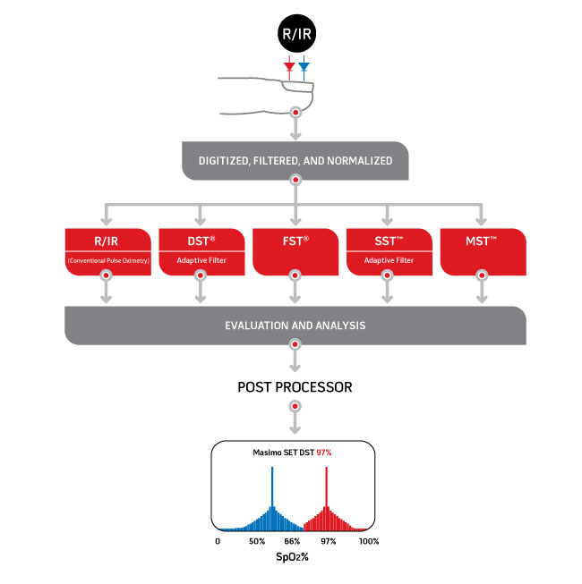 Masimo - Postprozessor, was der Unterschied ist Masimo SET